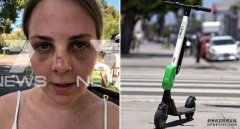 女子骑共享滑板车摔断鼻子状告Lime公司