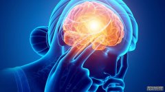 世界大脑日：偏头痛影响全世界七分之一的人，