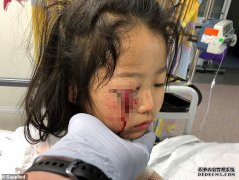慎入:6岁女孩在Kmart购物发生恐怖事故  脸砸到衣