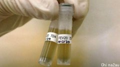 卫生部：奥克兰南区污水检出新冠病毒弱阳性