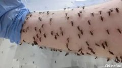 墨尔本小哥每天让5千只蚊子咬自己！为了让全球