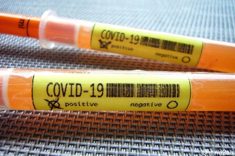 Coronavirus stock non breaking.jpg,0