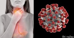 澳洲研究：胃酸倒流患者若染新冠肺炎，重症住