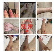 澳华人情侣闹分手，女方自述惨遭家暴被打伤！