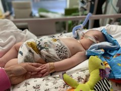 维州四个月大婴儿感染JEV的经历