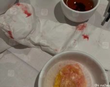 CBD中餐馆甜品吃出碎瓷片，悉尼华人嘴被划伤出