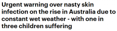 天气炎热潮湿小心皮肤病！澳女童患上湿疹瘙痒