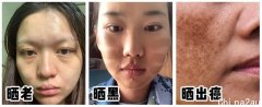 “长期防晒”和“不涂防晒”的脸有什么区别？说出来你一定不信！！