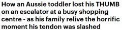 惊魂一刻！悉尼亚裔男童逛商场遭遇意外，手指被切断，血流如注（视频/组图）