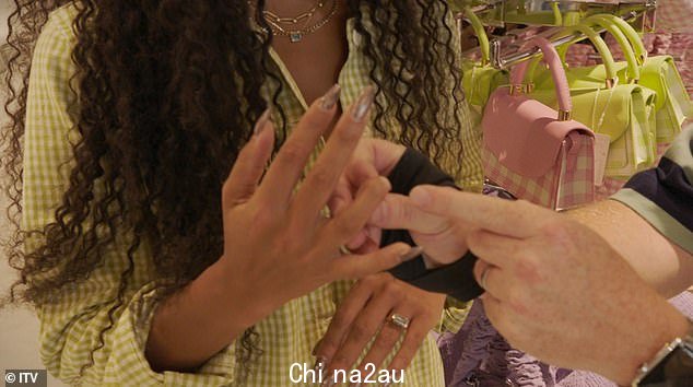 Reveal: Vick Hope 透露,在津巴布韦三岁的时候,她在一次事故中被砍断手指后,她下意识地隐藏了缺失的手指
