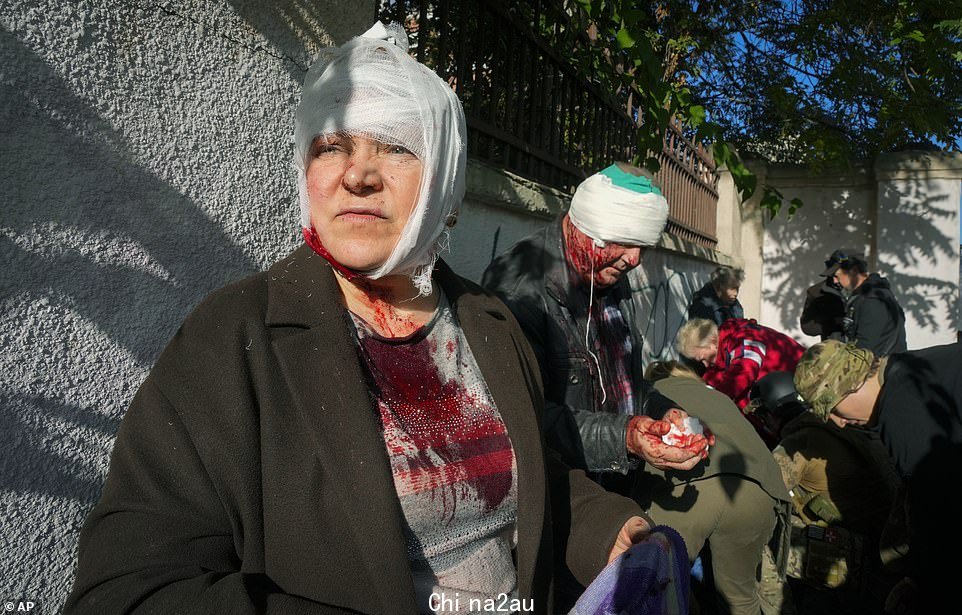 KYIV: 乌克兰人在今天早上俄罗斯导弹袭击首都时被飞弹炸伤,在火箭击中地点附近的公园里被军医修补