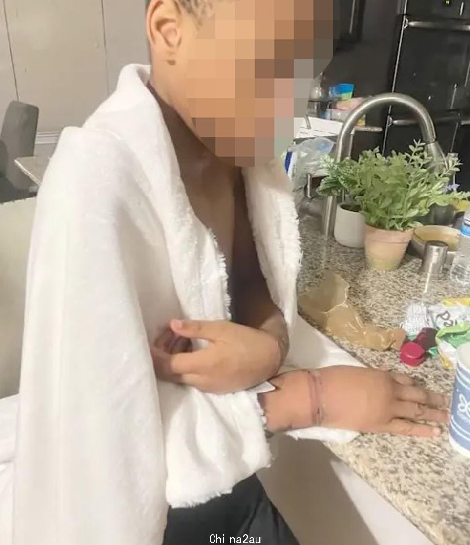 最终找到这对双胞胎的女人也被确认了身份,她说她发现他们的形状令人震惊:“他们太瘦了,太虚弱了.他们只是看起来经历了很多。他们告诉我,他们的妈妈把他们锁在洗衣房里,赤身裸体,从脚踝处系上拉链,从手腕上戴上手铐'