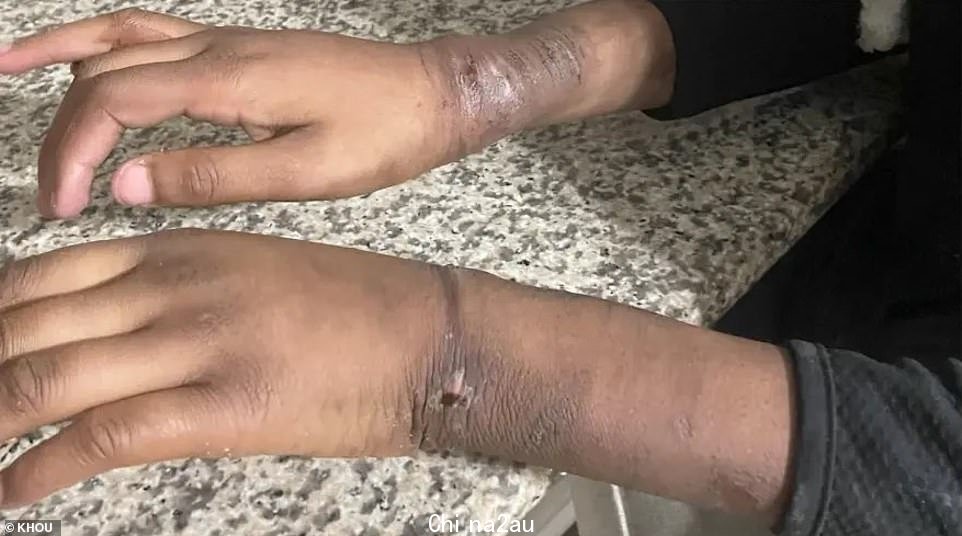 他们发现这对双胞胎,一个男孩和一个女孩,身材非常糟糕,“手腕上有痕迹,手铐上的痕迹很深”,据县警察说okesperson