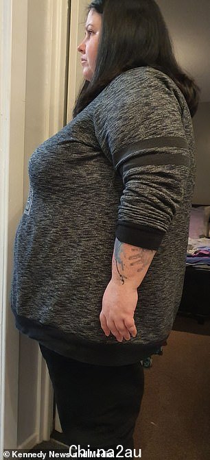 她在 2019 年开始患有压力性头痛,并被诊断出患有颅内高压 - 大脑周围的压力积聚会导致视力丧失