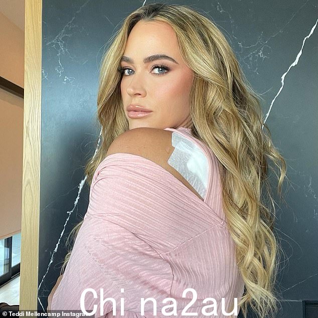 记录:早在三月份,这位真人秀明星称赞她的朋友女演员凯尔·理查兹发现她背上的一颗痣已经变色并催她去看医生
