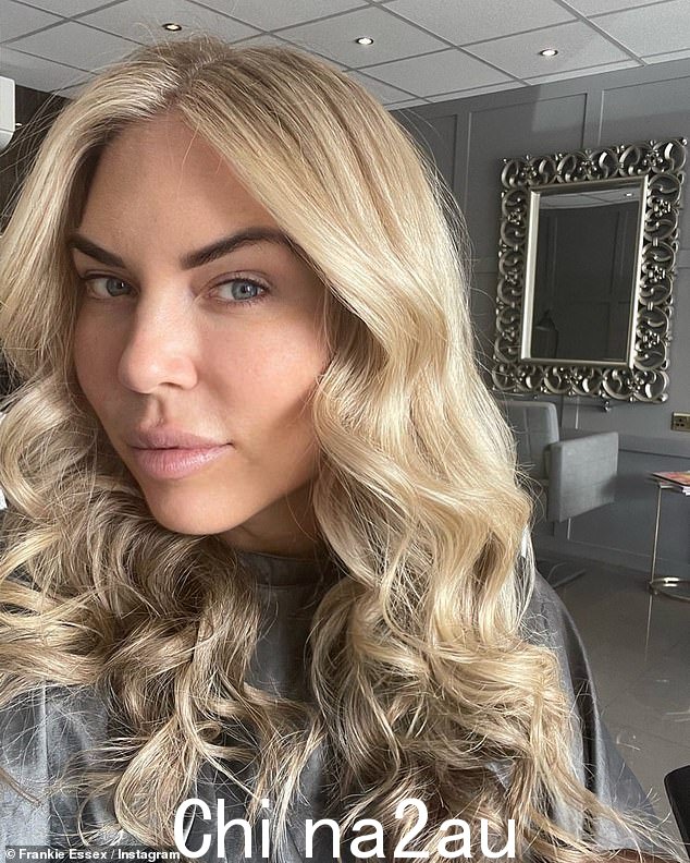 震惊:Frankie Essex 详细介绍了她的儿子 Logan 在常规疫苗接种导致腿部脓肿后的“可怕”紧急手术折磨