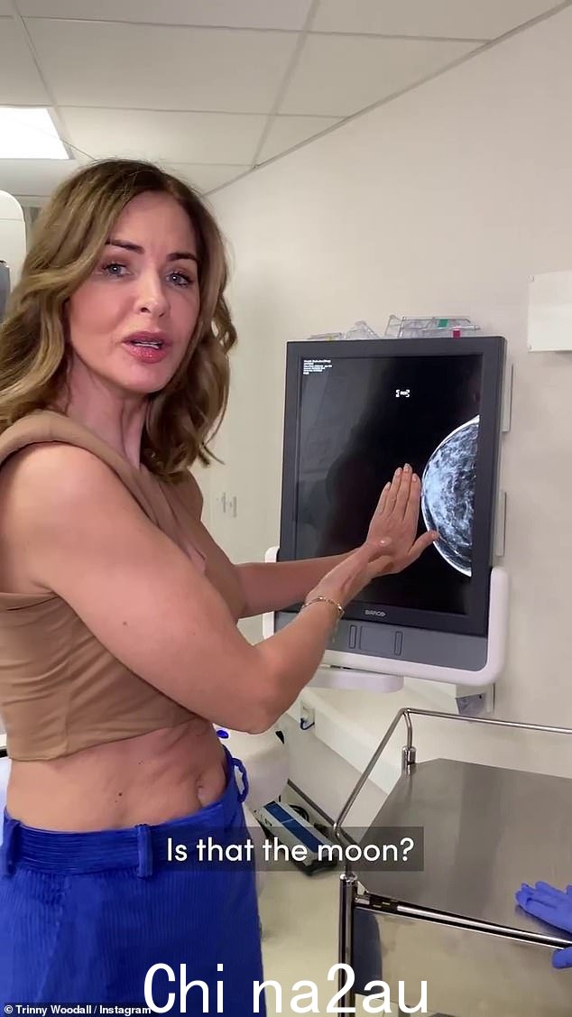 公开:Trinny Woodall 带着她的追随者去拍了乳房 X 光照片,拍摄了她的预约并在周一发布到 Instagram
