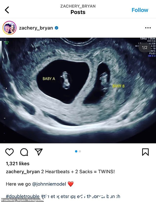 Twinscoming: The Home Improvement alum 发布了 Faye 超声检查的视频和照片,将双胞胎标记为“Baby A”和“Baby B”