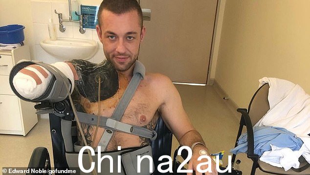 Gabriel 'Gabe' McKenna-Lieschke (如图) 从诱导性昏迷中醒来,在非常强效止痛药的迷雾中发现他的右臂不见了