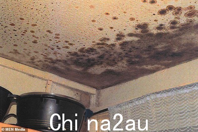 Awaab 的气道和喉咙“严重肿胀”。测试还在他的血液中发现了真菌