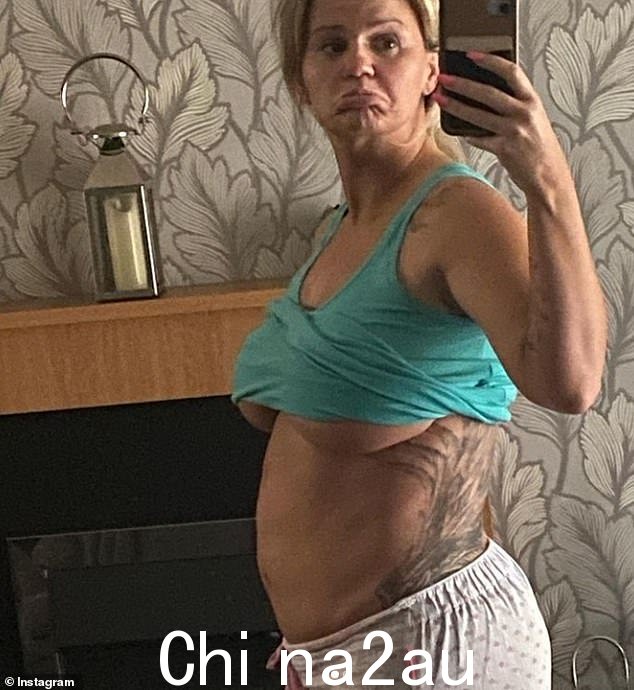 Candid: 她说她就像“宜家的扁平包装”,外科医生必须“把我重新组合起来”。如图2021 年 6 月