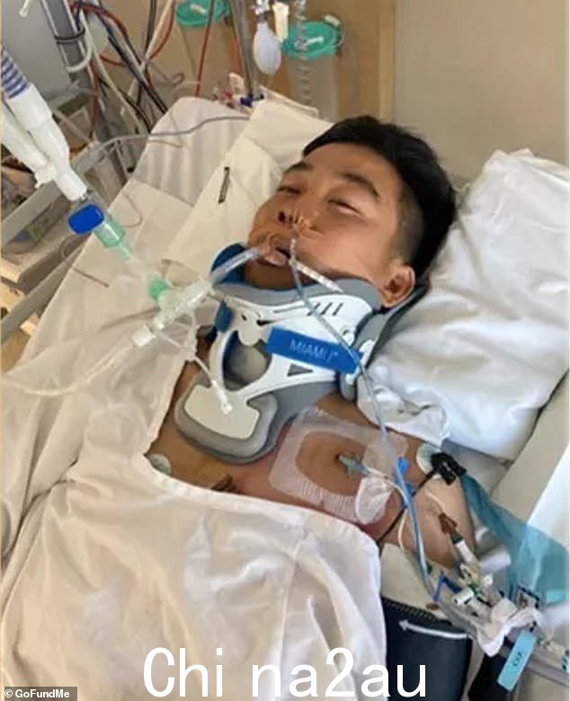 一次意外事故后,森下晴人的生活将不再一样。他描绘了在悉尼皇家北共享医院的 ICU 中与呼吸管相连