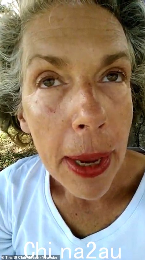 本周,有消息称比蒂被一位名叫克里斯蒂娜赫希(如图)的 63 岁女性起诉,她声称这位演员在她 14 岁时为她做爱,当时他 35 岁