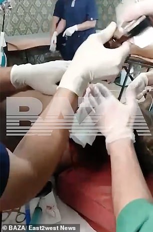 医务人员从俄罗斯士兵的背上取下炮弹的尾巴后就可以看到了