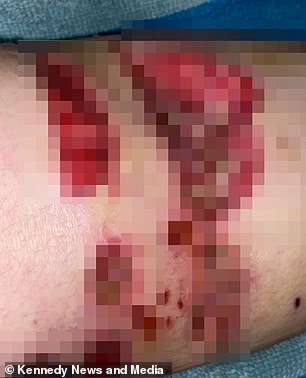 这头被放下的斗牛犬咬紧牙关n 用力压在她身上,她能听到他的牙齿磨她骨头的声音