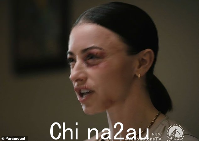 酒吧争吵:当贝丝殴打的女人出现在警察局时,杰米告诉她,如果她提出指控,她将面临起诉