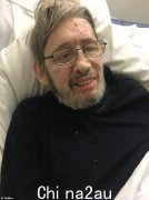 肖恩·麦克高恩 (Shane MacGowan) 妻子更新健康状况后恢复战斗状态