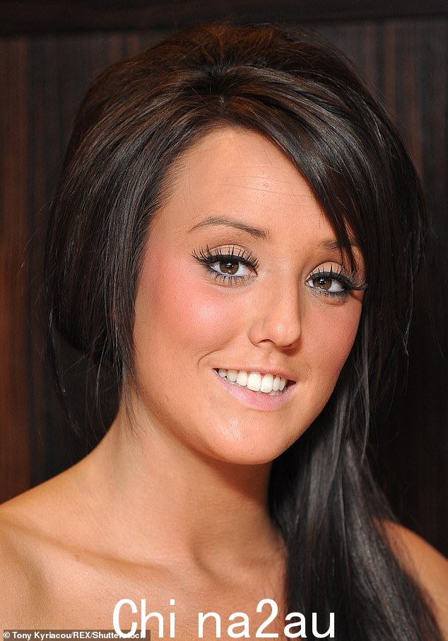 天生丽质:夏洛特,作为 2011 年 MTV 的 Geordie Shore 的原班人马之一而声名鹊起,在当年该节目的宣传照中可以看到她的嘴唇较小