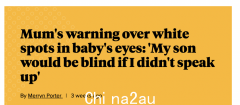 做妈妈不容易！澳洲孩子因此几乎失明，有此症状要小心（图）