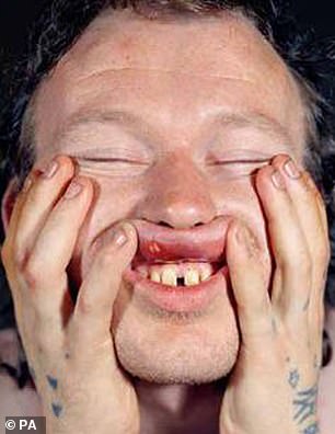 Dennis McGrory showing his teeth