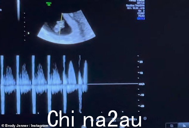 他们在周日的联合 Instagram 帖子中披露了新年伊始