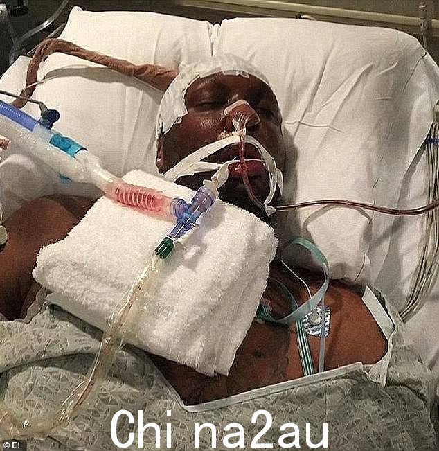 被骗死亡:卡戴珊家族的制片人明星在 2013 年提出与拉马尔离婚,但当他在拉斯维加斯一家妓院吸毒过量近乎致命后陷入 72 小时昏迷时,他一直陪伴在拉马尔身边 Love 2015年10月牧场