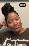 Keke Palmer 声称她在“尝试一切”清洁皮肤后“被击倒”，从而“治愈”了粉刺