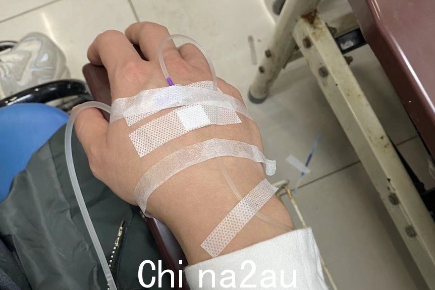 输液管插入手背
