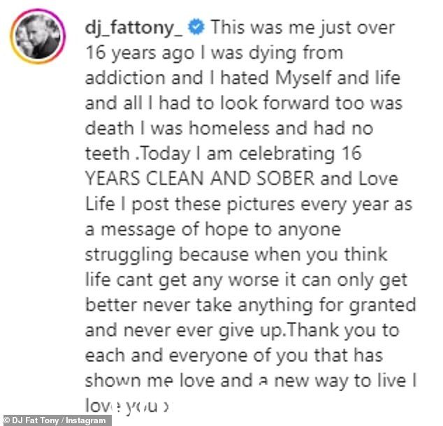 希望的讯息:56 岁的音乐明星,真名 Tony Marnach,在 Instagram 上分享了令人痛心的照片,透露他无家可归,并且由于他的习惯而没有牙齿