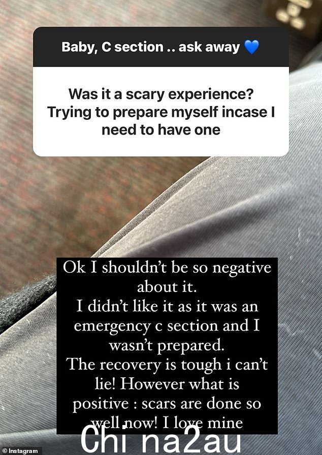 '好吧,我不应该对此如此消极。我不喜欢它,因为它是紧急剖腹产而且我没有做好准备,'她说
