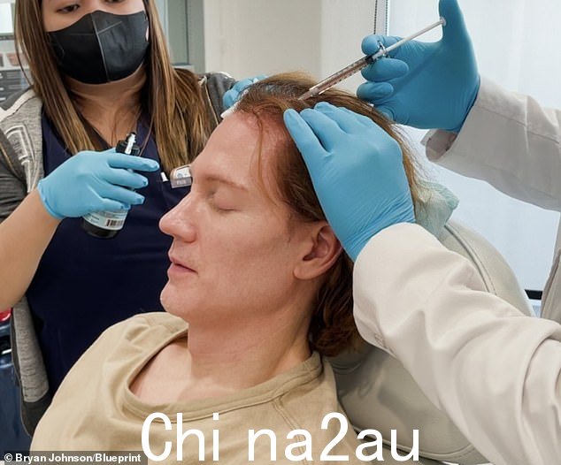 通过他的冒险,'项目蓝图,乔hnson 和他的医生说,他的整体生理年龄减少了 5 岁多,现在拥有 37 岁的心脏、28 岁的皮肤以及 18 岁的肺活量和健康状况-old