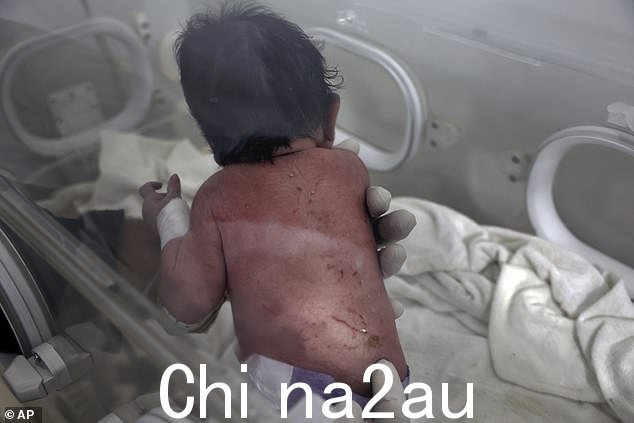 这个女婴是在她的母亲被埋在一栋五层公寓楼的废墟下时出生的,她的后背上有碎片留下的伤口