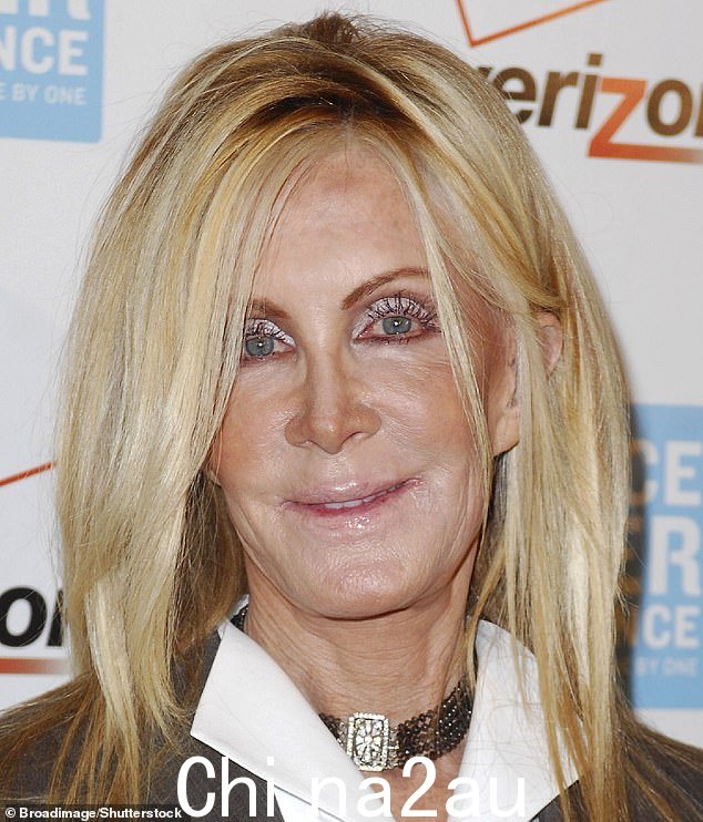 Knots Landing 明星 Joan Van Ark 拥有电视上最著名的面孔之一 - 但当她在 2007 年以全新的面貌出现在一个活动中时,她已经面目全非