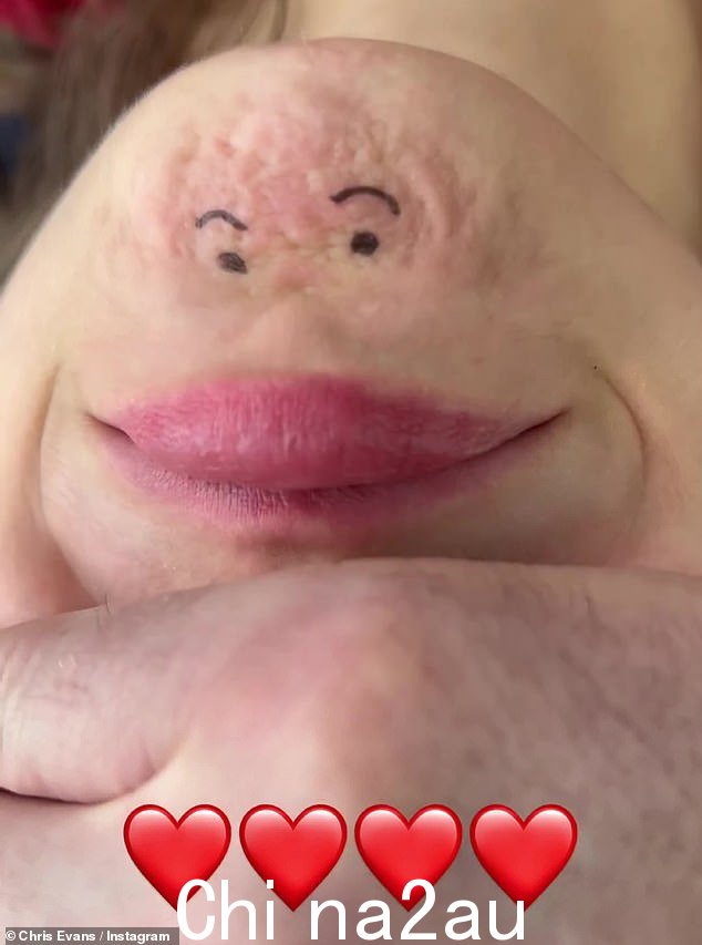 愚蠢:Chris 还发布了一些关于他的爱的搞笑视频,包括他们在她的下巴上画了一个颠倒的脸