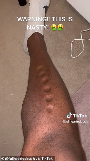 它显然留下了永久性的草皮