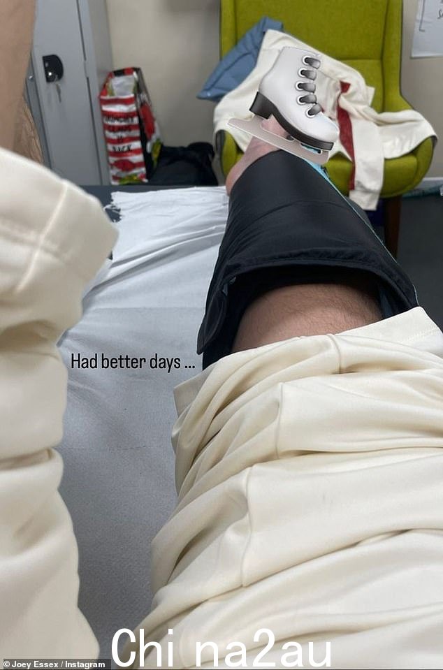 哎哟:承认他已经'看到了更好的日子',到目前为止在比赛中给评委留下深刻印象的帅哥分享了一张他缠着绷带的腿的照片