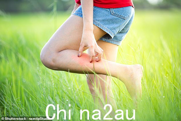 根据皮肤科医生的说法,最好只是忍受瘙痒的感觉。虽然挠痒痒是可以的,但如果你持续这样做,可能会导致瘙痒循环