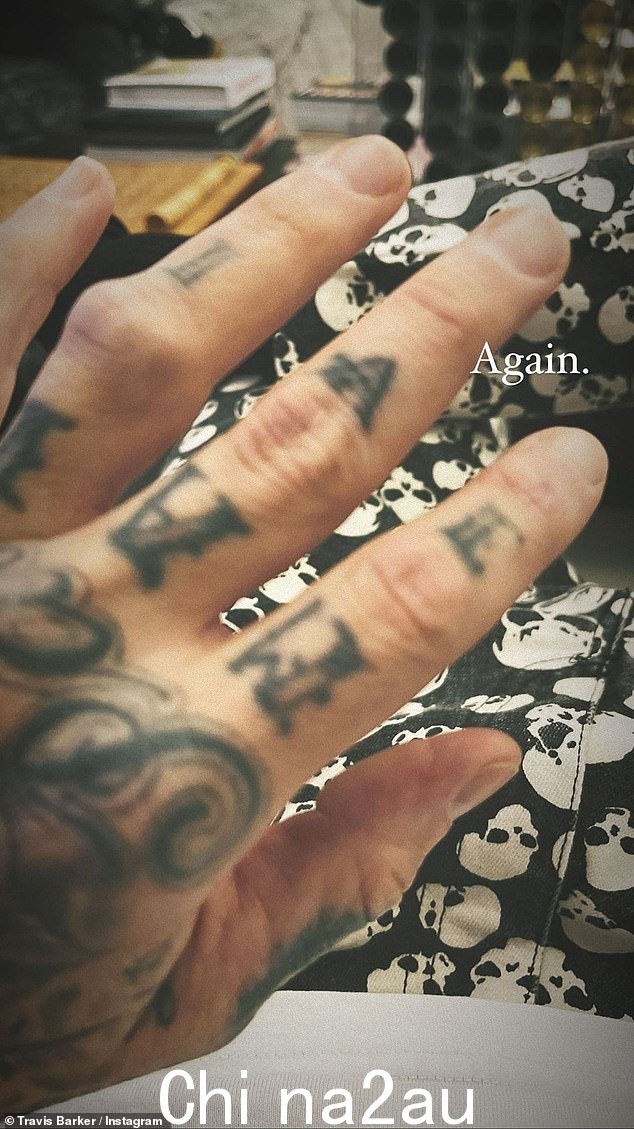 哎哟:就在一天前,这位三个孩子的父亲在 Instagram 上与粉丝们分享了他第二次折断无名指的消息