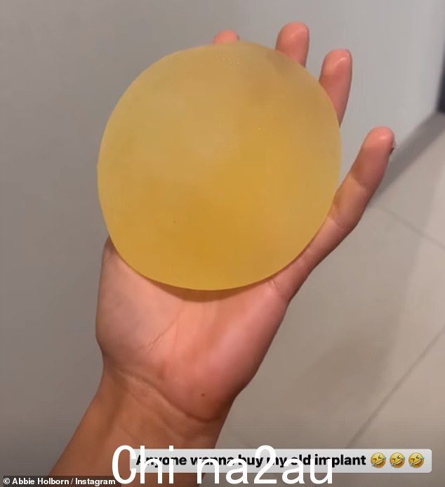 旧的:这位真人秀明星拍摄了自己拿着旧的乳房植入物的视频,但没有透露她第二次手术选择的尺寸