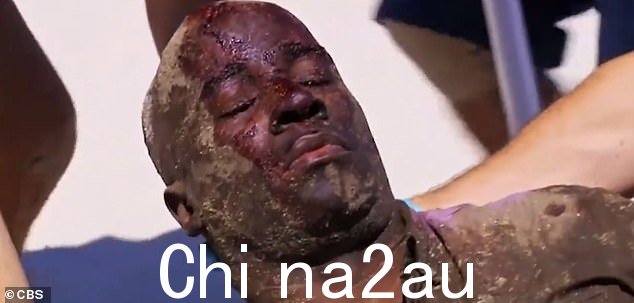第一次挑战:Perreault 是 Tika 部落的一员,他在第一次身体挑战中受伤